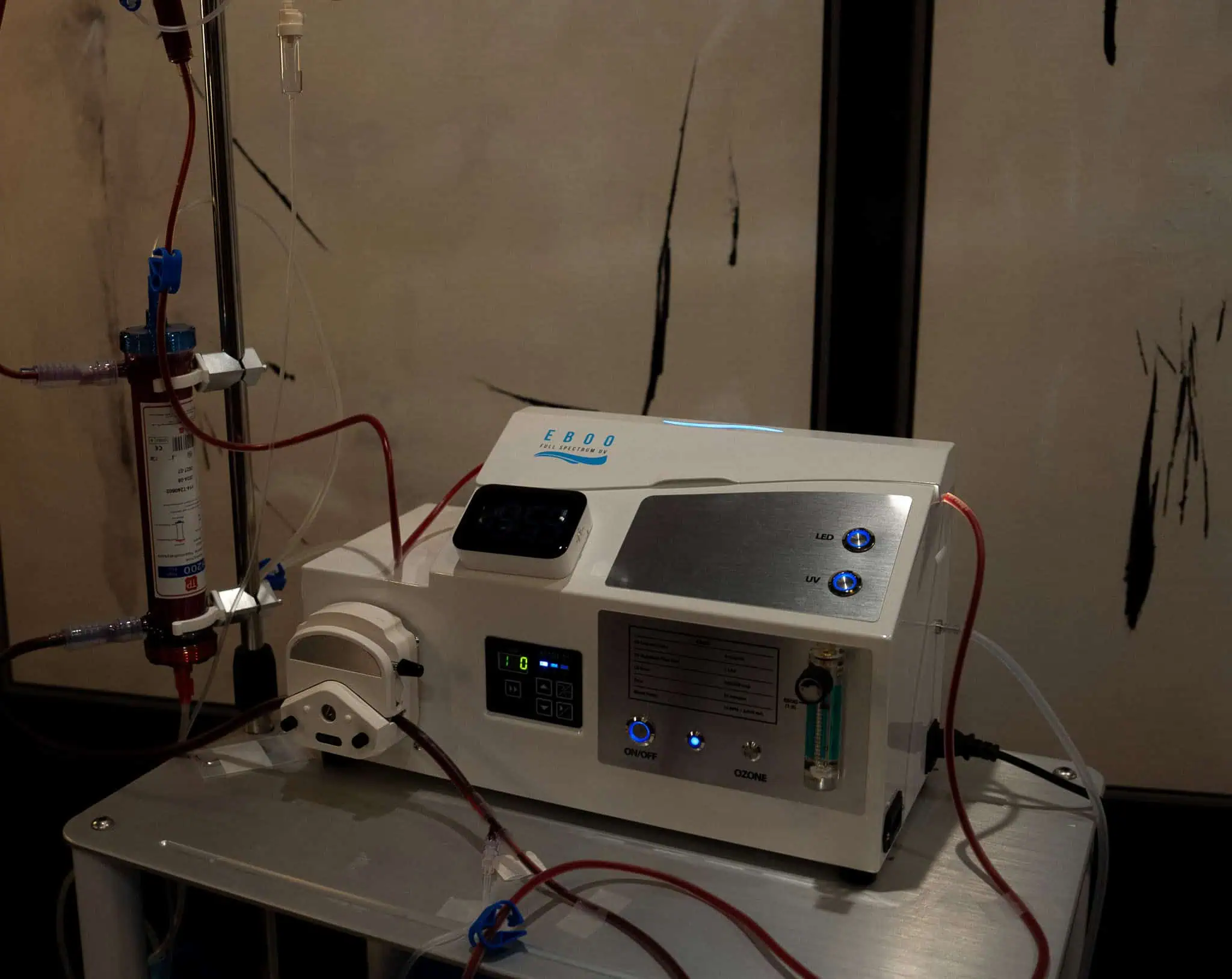 EBOO & Ozone Therapy: An Innovative Approach to Wellness