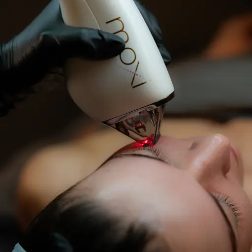 Laser Skin Treatments
