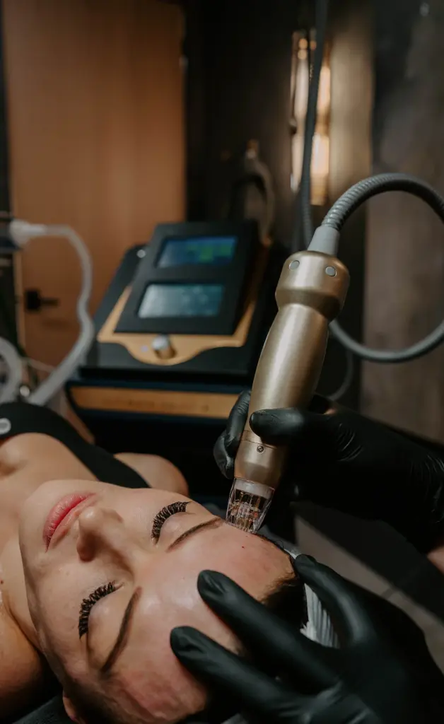 Sylfirm X RF Microneedling